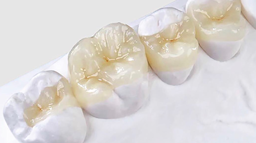 Rehabilitación post endodoncia