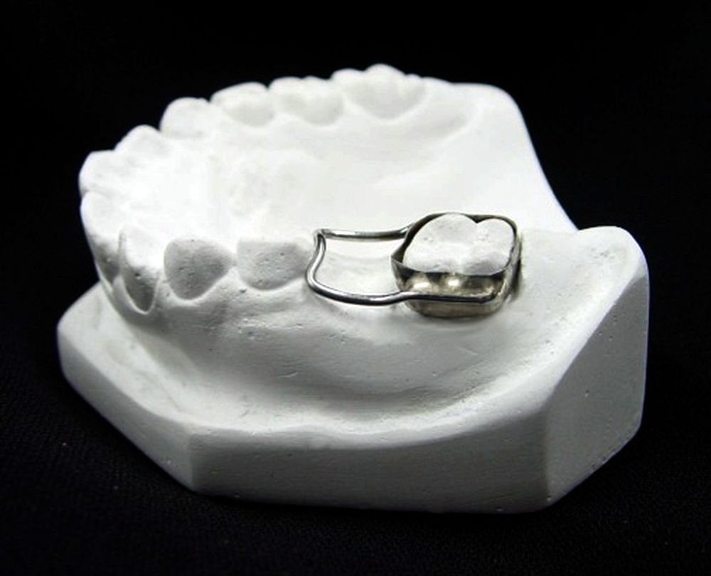 Mantenedores de Espacio